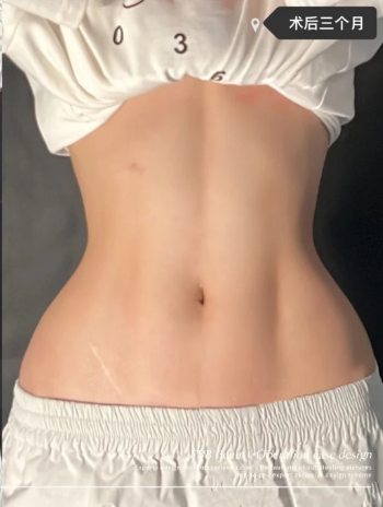 术后