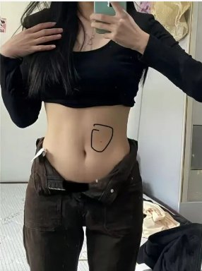 术后