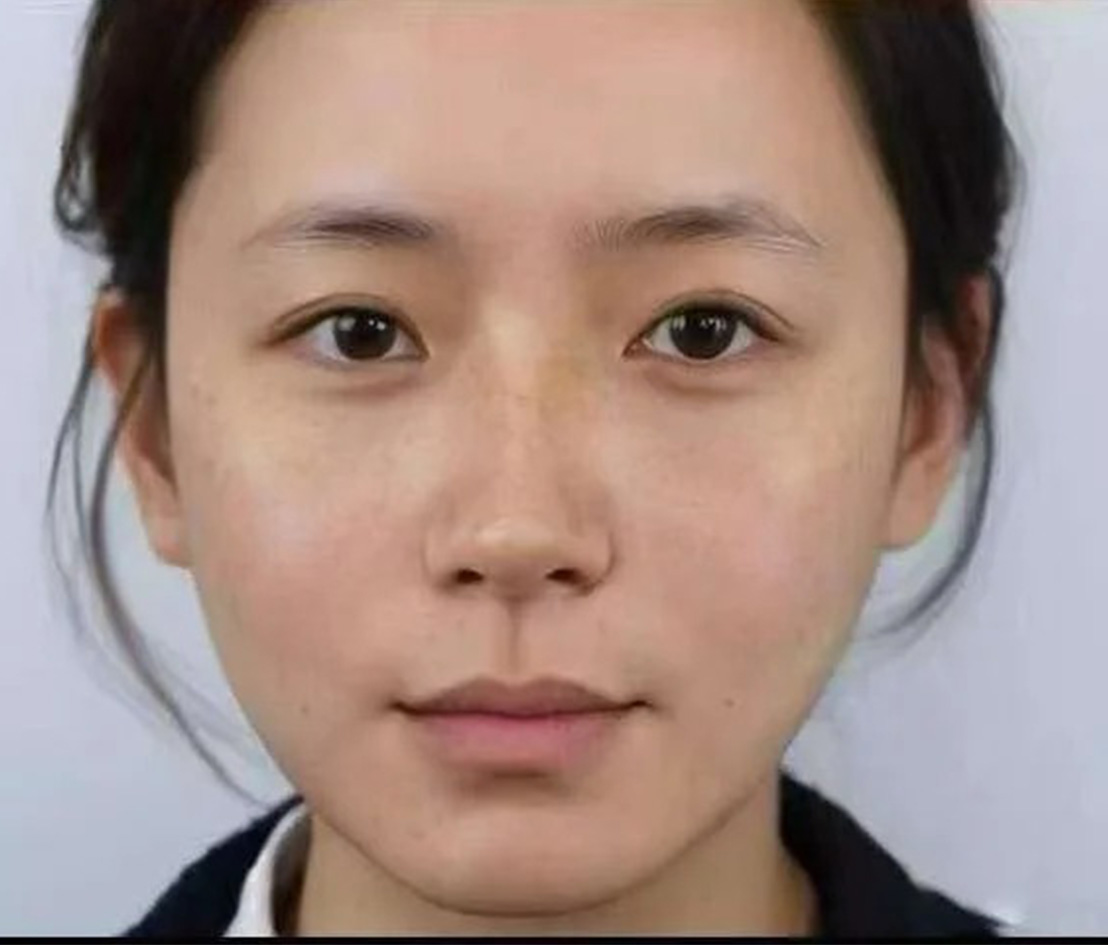 术后