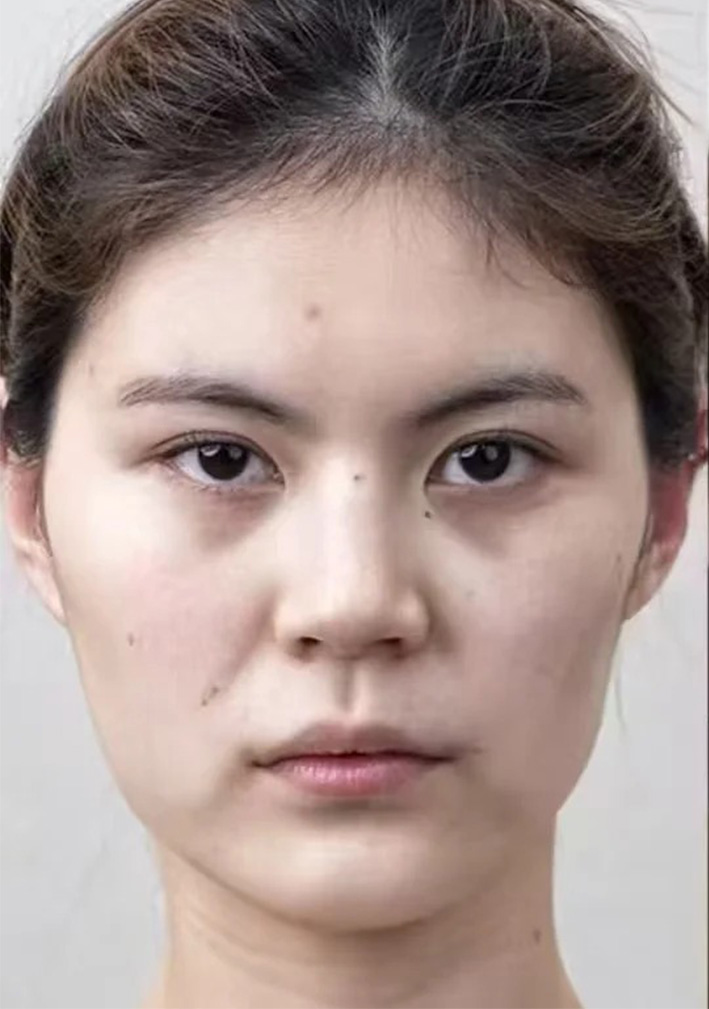 术前