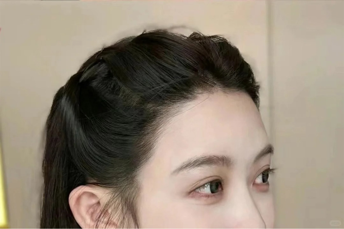 术后