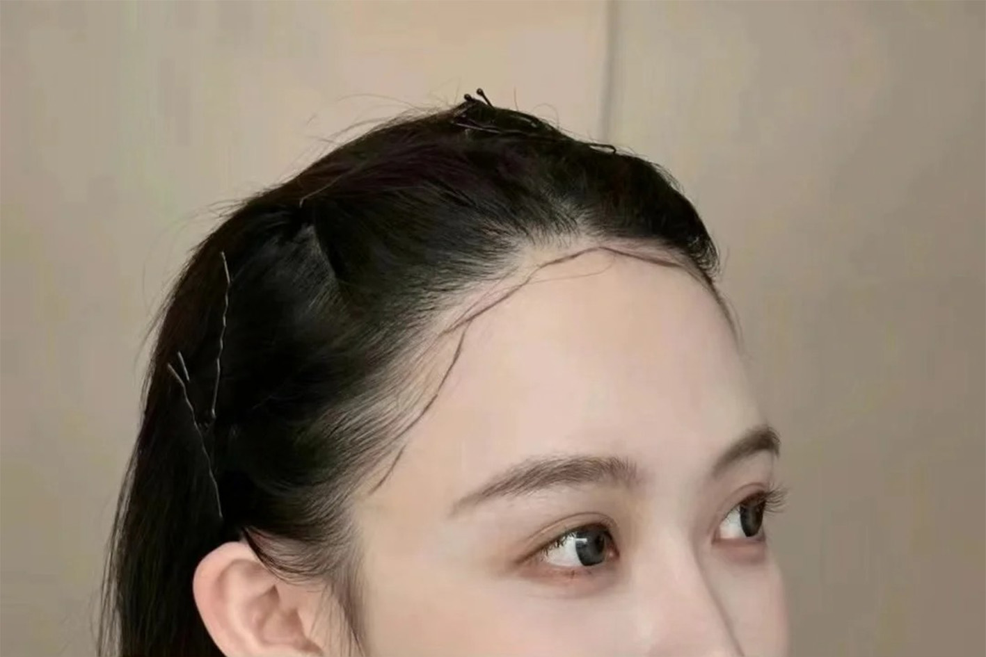 术前