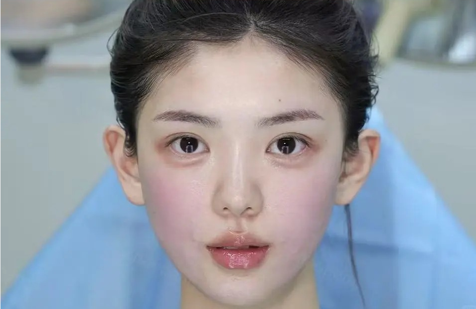 术后