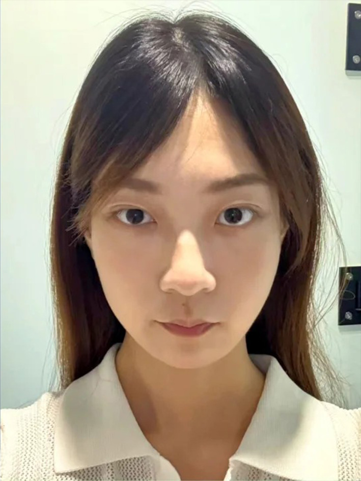 术后