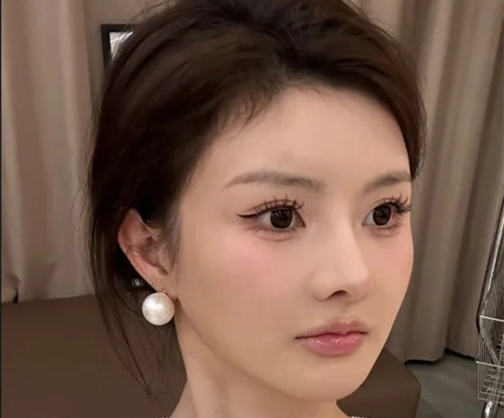 术后