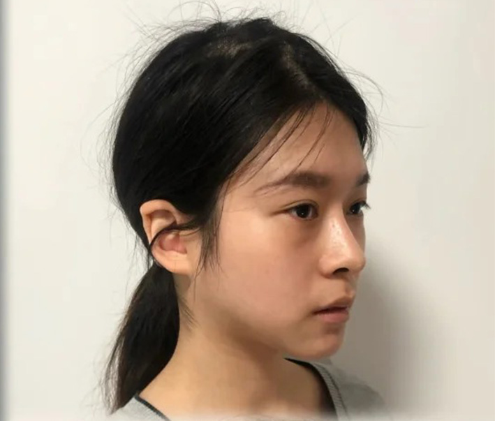 术后