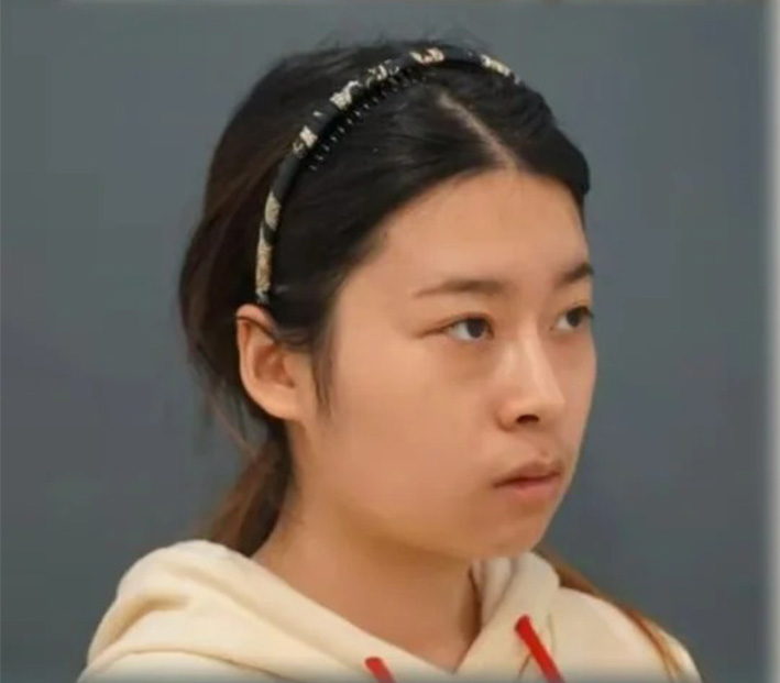 术前