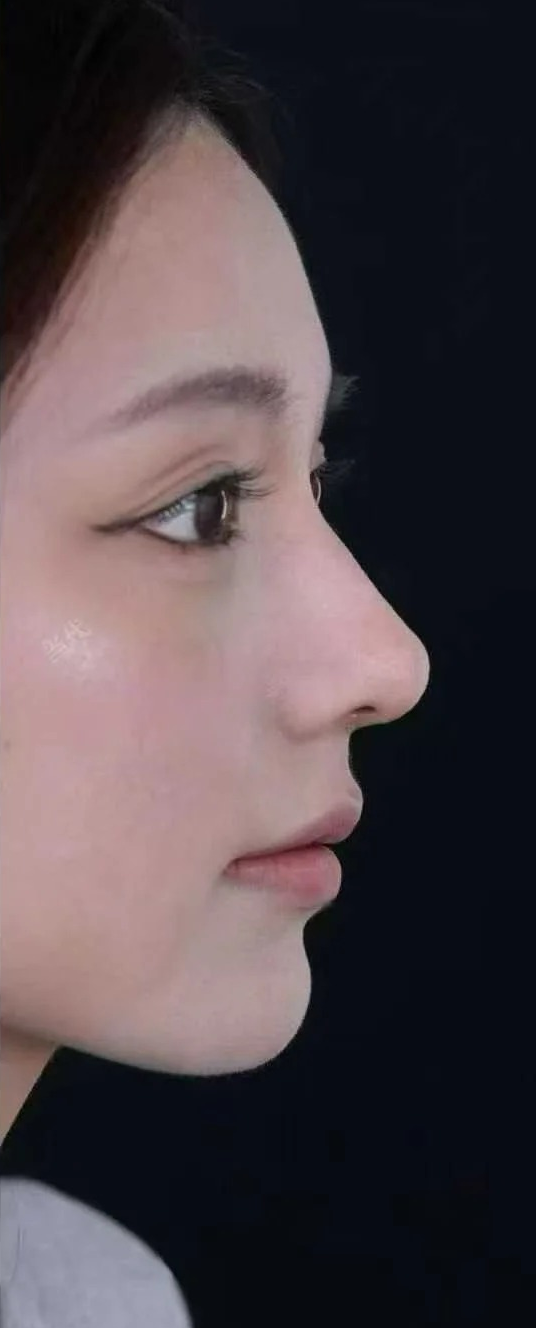 术后
