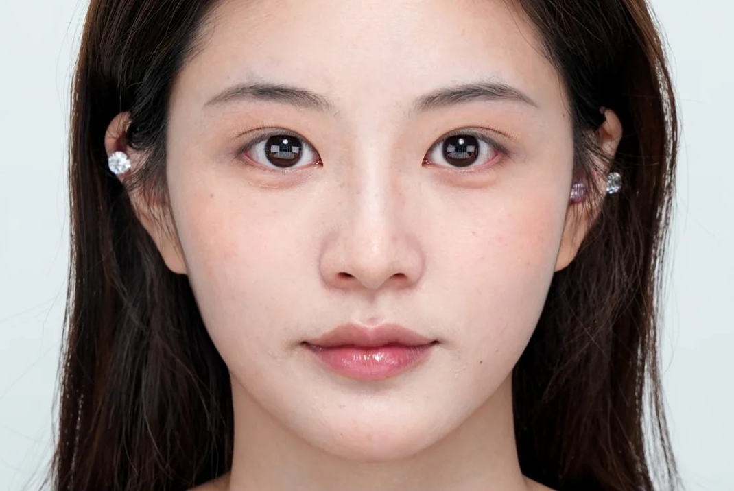 术后